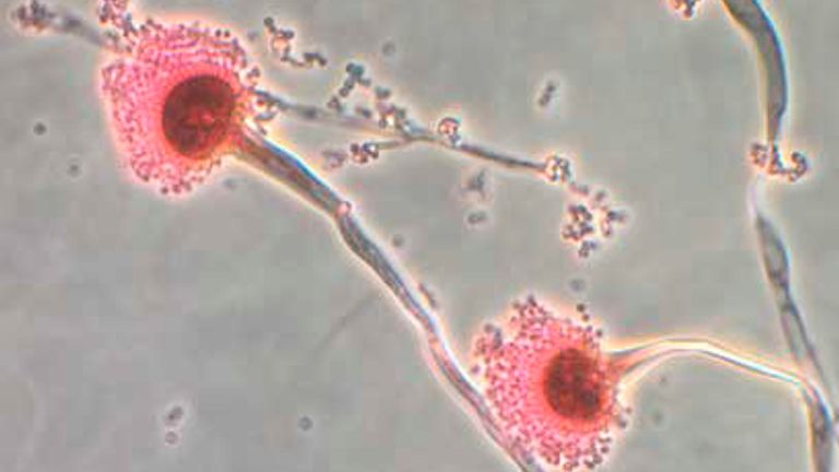 Aspergillus, тип грибов, наблюдается на этом изображении раздаточного материала из Центров по борьбе с заболеваниями, 13 октября 2012 года. CDC продолжает подтверждать наличие гриба Exserohilum в клинических образцах от людей с менингитом. В настоящее время только один клинический образец положил положительный результат на гриб Aspergillus. PIC: Reuters