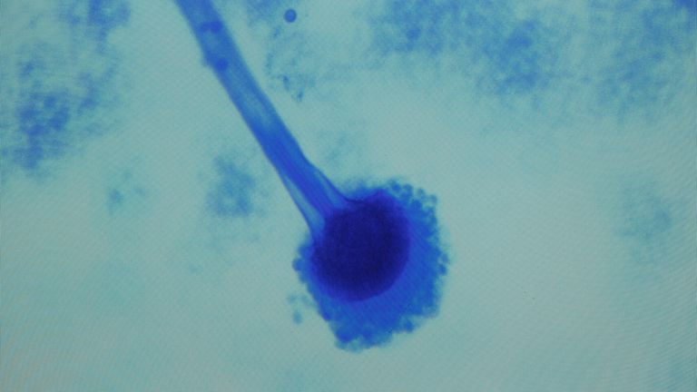 Образец Aspergillus Fumigatus, первого гриба, диагностированного в грибковом менингите, охватывающем Соединенные Штаты, в Нэшвилле, штат Теннесси, 19 октября 2012 года. Вспышка, которая впервые была диагностирована в лаборатории клинической микробиологии Вандербильта для ухода за пациентами, заразила 257 человек на сегодняшний день по всей стране и 20 умерли. PIC: Reuters